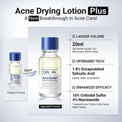 🌸Overnight Acne Spot Treatment - 10% Sulfur & Salicylic Acid (20mL)🌿