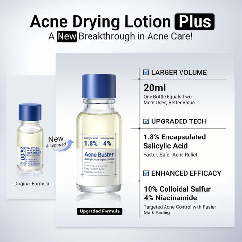 🌸Overnight Acne Spot Treatment - 10% Sulfur & Salicylic Acid (20mL)🌿