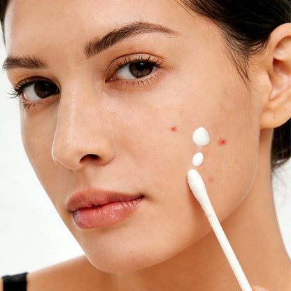 🌸Overnight Acne Spot Treatment - 10% Sulfur & Salicylic Acid (20mL)🌿