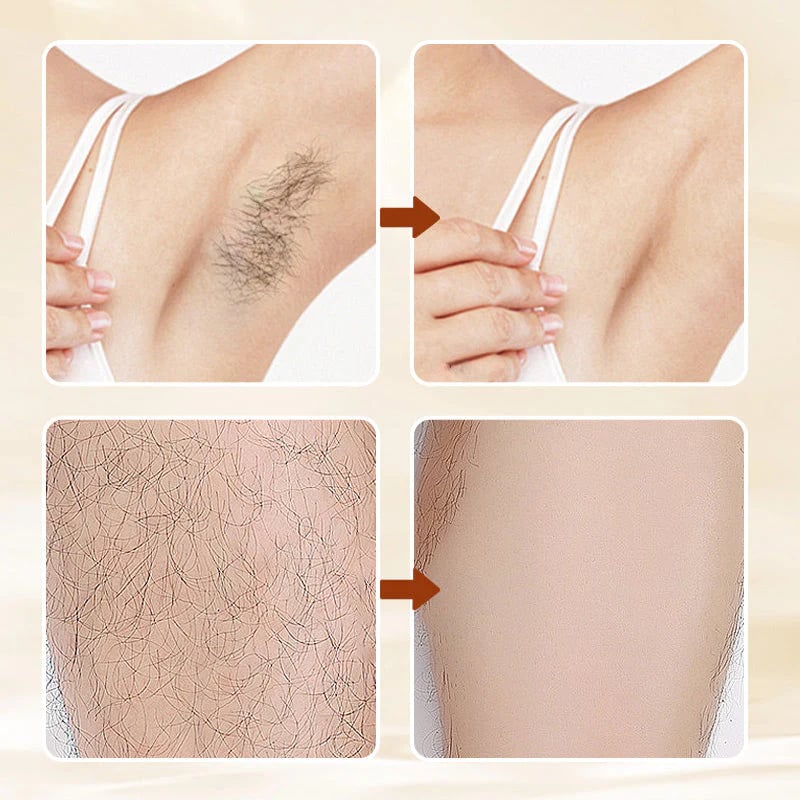 🧴49% OFF!🥰 Mild Hair Removal Cream ✨ Fast-Acting Smooth Skin | Pleasant Fragrance for All Skin Types