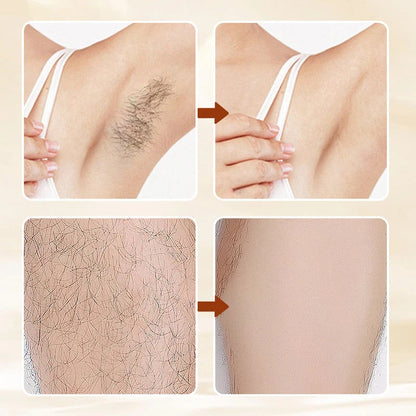🧴49% OFF!🥰 Mild Hair Removal Cream ✨ Fast-Acting Smooth Skin | Pleasant Fragrance for All Skin Types